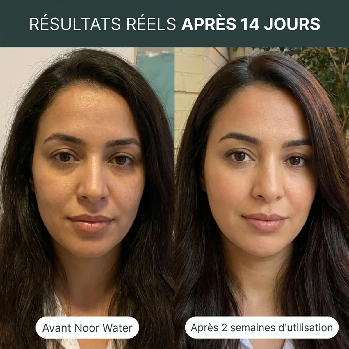 Peau & cheveux transformés en 2 semaines
